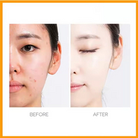 //rlrorwxhjpmlli5p.ldycdn.com/cloud/prBprKjllrSRqlqipiinkq/Skin-Care10.jpg