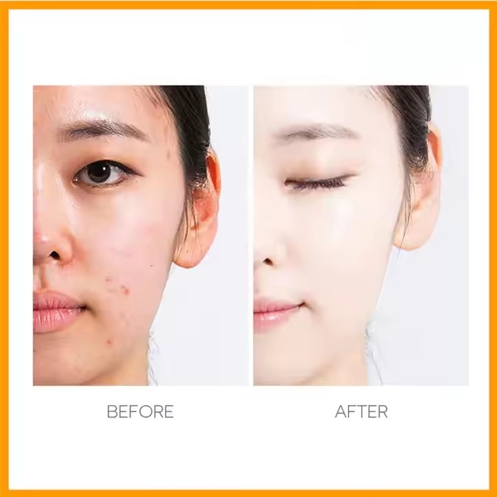 Ən Yaxşı Şəxsi Etiketli Dəriyə Qulluq İstehsal&ccedil;ıları - Niyə Guangzhou Aihuo Biotexnologiya Paketə rəhbərlik edir